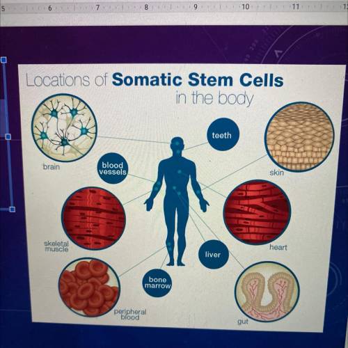 What is a somatic cell?