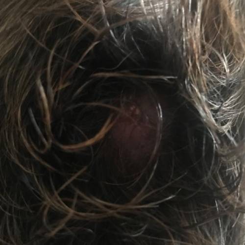 What's this on my dog?