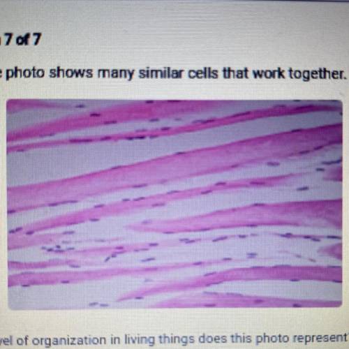 The photo shows many similar cells that work togethe.

Which level of organization in living thing