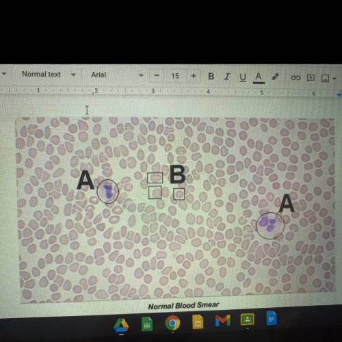 Help what are the cells labeled A and B
