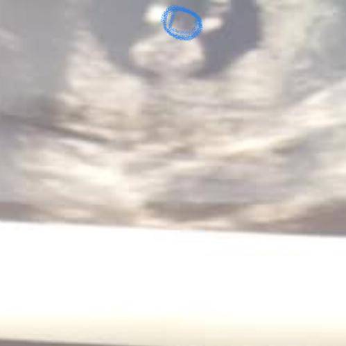 hi yo I’m pregnant/ exactly 12 weeks one day, I notice in my ultrasound pics that I see either an u