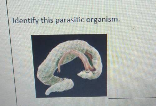 Identify this parasitic organism.