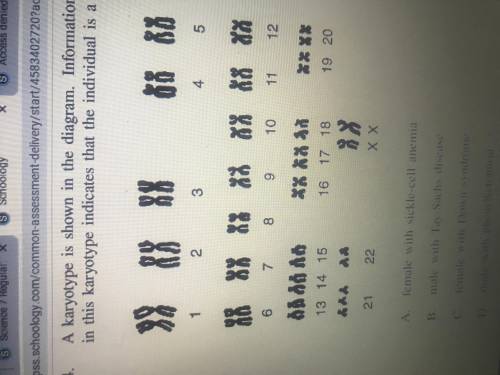 A karyotype is shown in the diagram . Information in this karyotype indicates that the individual i