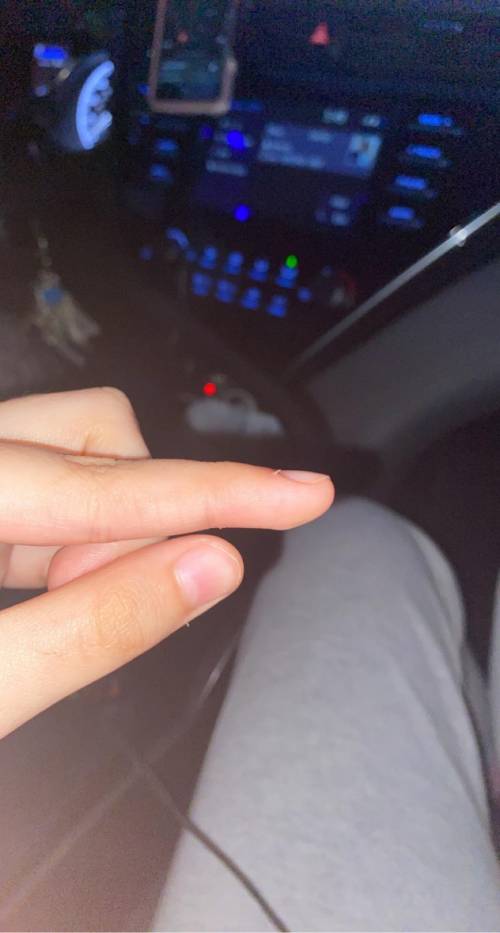 what is this thing on my finger called and what is it in general? this really isn’t for school but