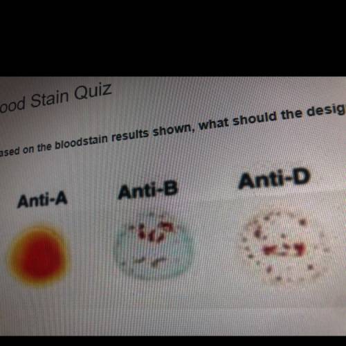 Based on the bloodstain results shown, what should the designated blood type be?

Anti-A
Anti-B
An