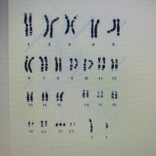 8. What is the sex (gender) of this karyotype?
