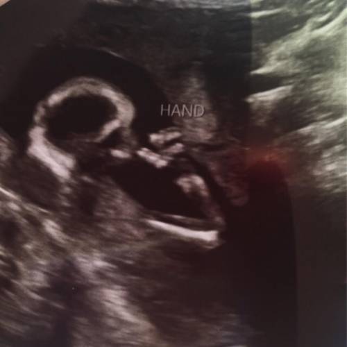 Hiiii I’m 16wks 2d prego!

Just got the coolest pic of my baby boy sucking his thumb! But I did no