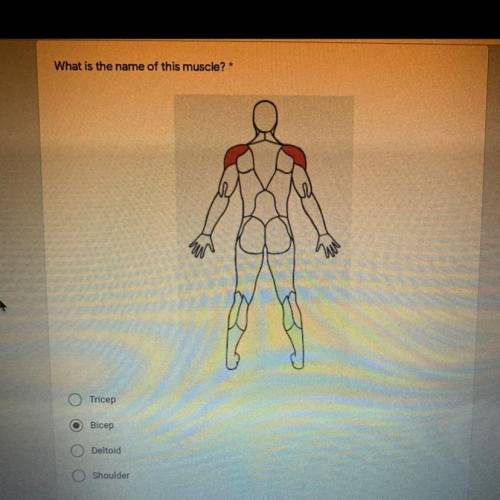 What is the name of this muscle?