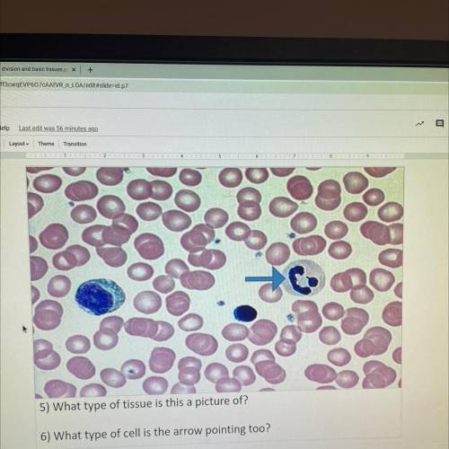 I’d really appreciate the help :))

5)What type of tissue is this a picture of?
6) What type of ce