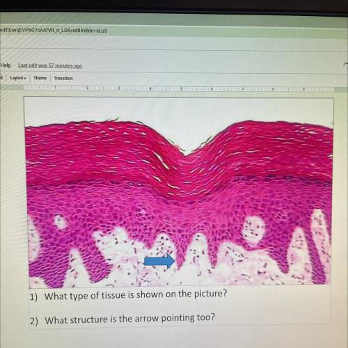I’d really appreciate the help :))

1) What type of tissue is shown on the picture?
2) What struct