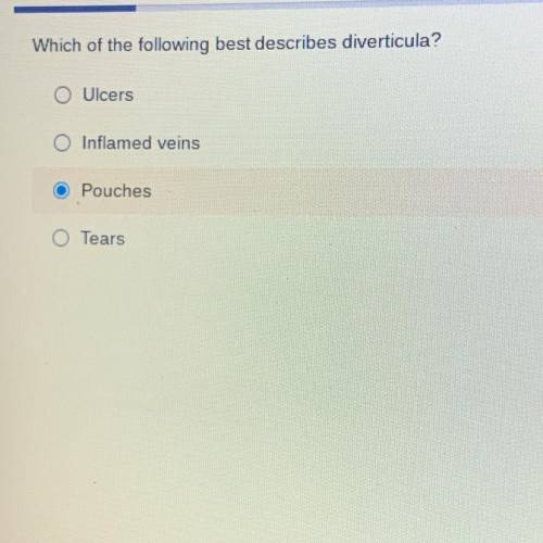 Which of the following best describes diverticula?

Ulcers
Inflamed veins
Pouches
Tears
PLEASE HEL