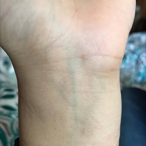 What color are my veins