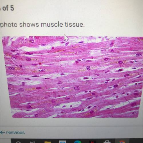 The photo shows muscle tissue.

What is the function of muscle tissue?
A. Can you send signals to