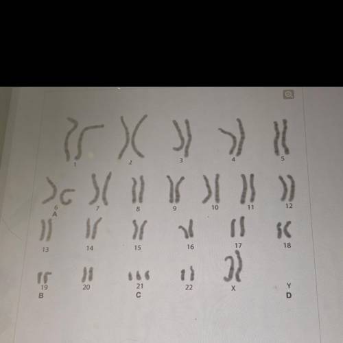 Which part of the karyotype reveals a genetic abnormality?

A. A
В. В
C. С
D. D
plzzz answer asap