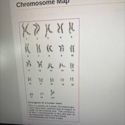 List the genetic disorders found on chromosome

11.
What do you know about any of those disorders?