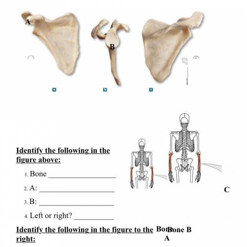 由南

Identify the following in the
figure above:
1. Bone
2A:
2.B:
Left or right?
Identify the follo
