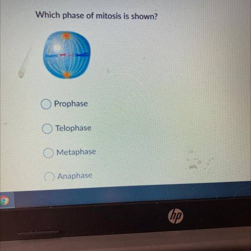 Which phase of mitosis is shown
