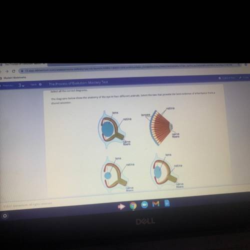 Select all the correct diagrams.

The diagrams below show the anatomy of the eye in four different