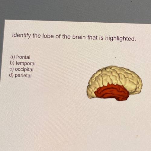 Identify the lobe of the brain that is highlighted.

a) frontal
b) temporal
c) occipital
d) pariet