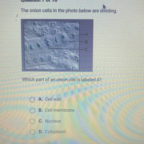 Which part of the onion cell is labeled A?