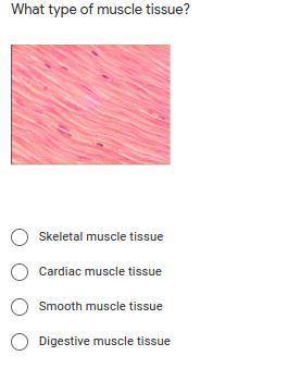 What type of muscle tissue is this