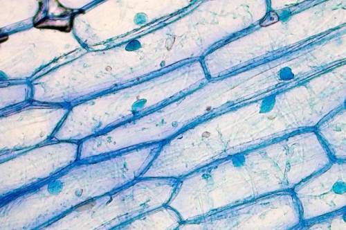 The very structured cells may viewed with a light compound microscope.

Are these cells from a Pro