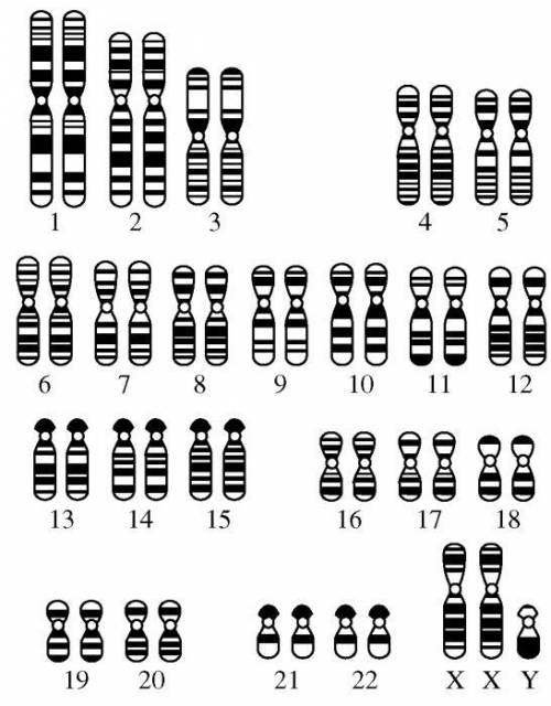 The diagram above depicts a karyotype of an individual human. Which of the following statements con