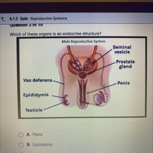 Please help ASAP !! “Which of these organs is an endocrine structure?”