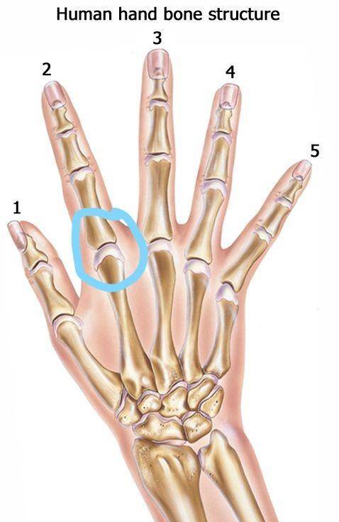 What body part is this (CIRCLED)