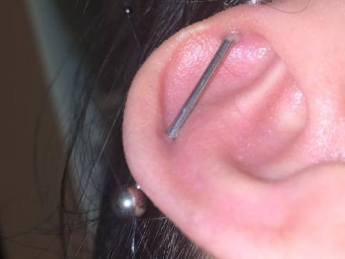 Marking brainliest *warning*

My industrial piercing is about 2 weeks old and can you guys tell me
