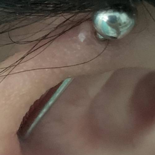 Is my piercing infected ? I got it done a month ago