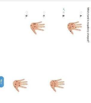 Which hand is negatively charged​