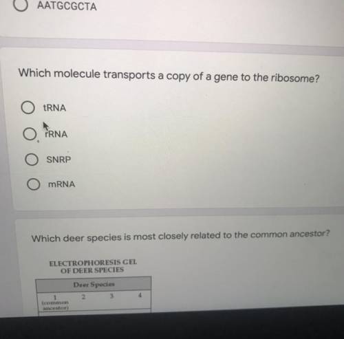 Which molecule transports a copy of a gene to the ribosome?
tRNA
rRNA
SNRP
mRNA