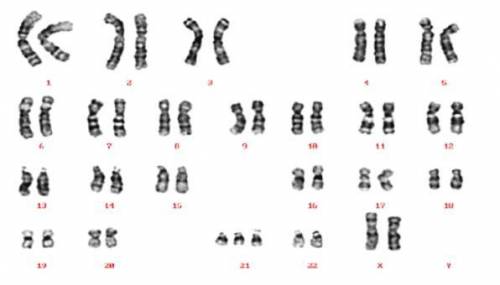 What is the sex of the person in this Karyotype?