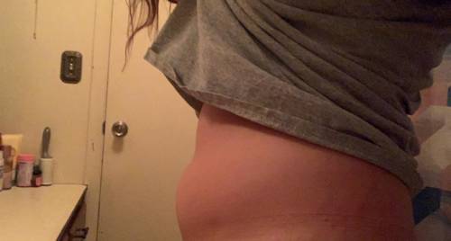 HELP. Does this look like a pregnancy bump?? Do you think I’m okay?