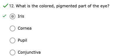 What is the colored, pigmented part of the eye?