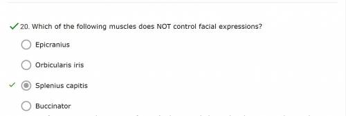 Which of the following muscles does NOT control facial expressions?
