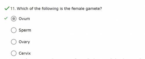Which of the following is the female gamete?