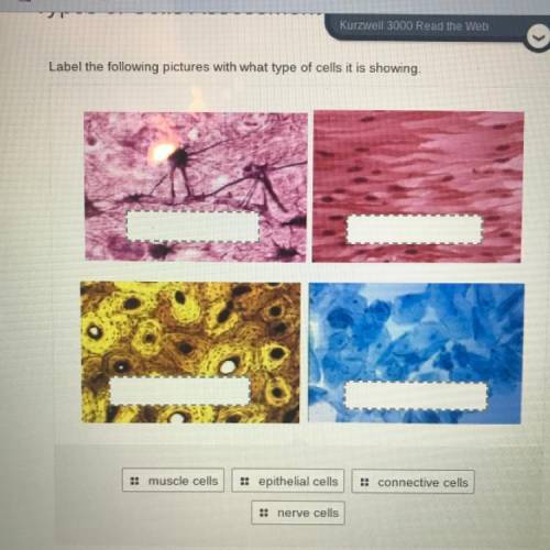 Label the following pictures with that type of cells it is showing