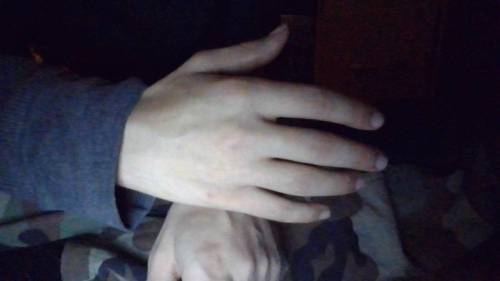 Why are my hands so ugly?