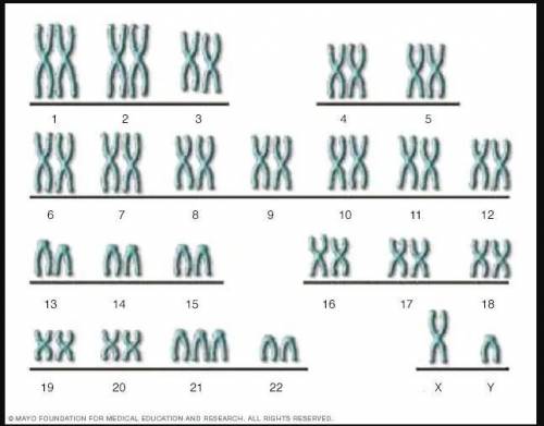 What do you think is the reason why an extra copy of chromosome 1, 2, 3, 4 or 5 results in more seve