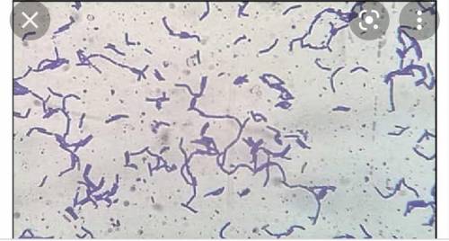 Bacteria looks more?