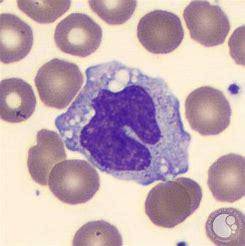 What is the largest leukocyte that contains small cytoplasmic granules and typically a kidney- or ho